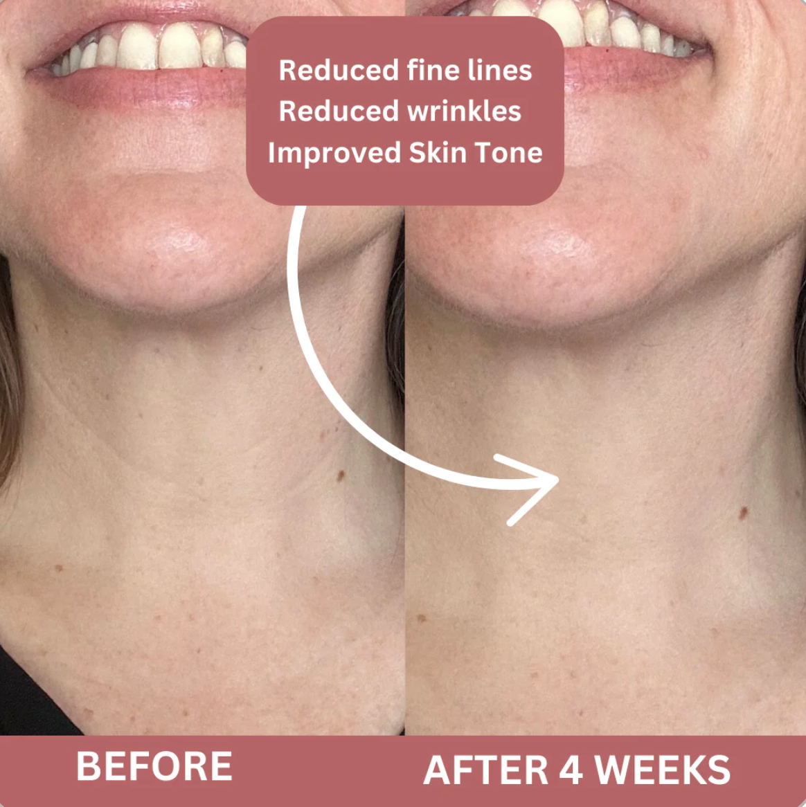 Bio-Collagen Neck Mask